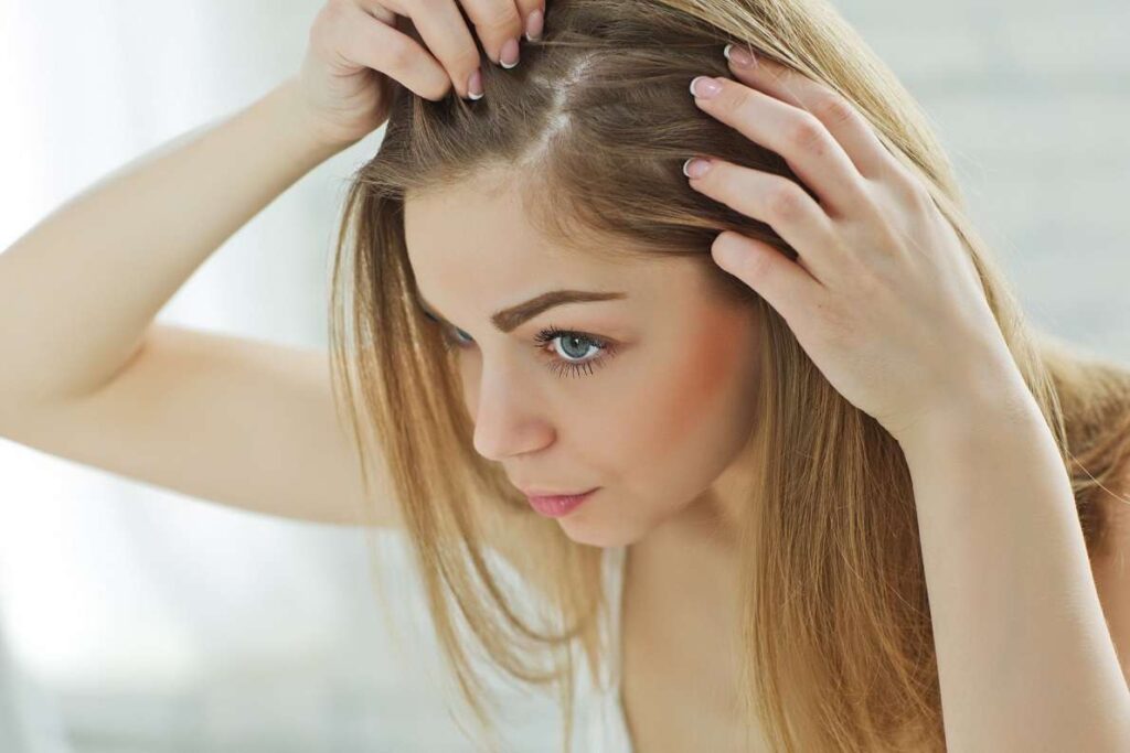 عوامل رایج ریزش مو در زنان
